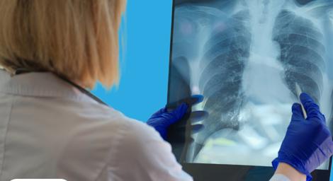 Heath professional holding up an image of a chest X-ray