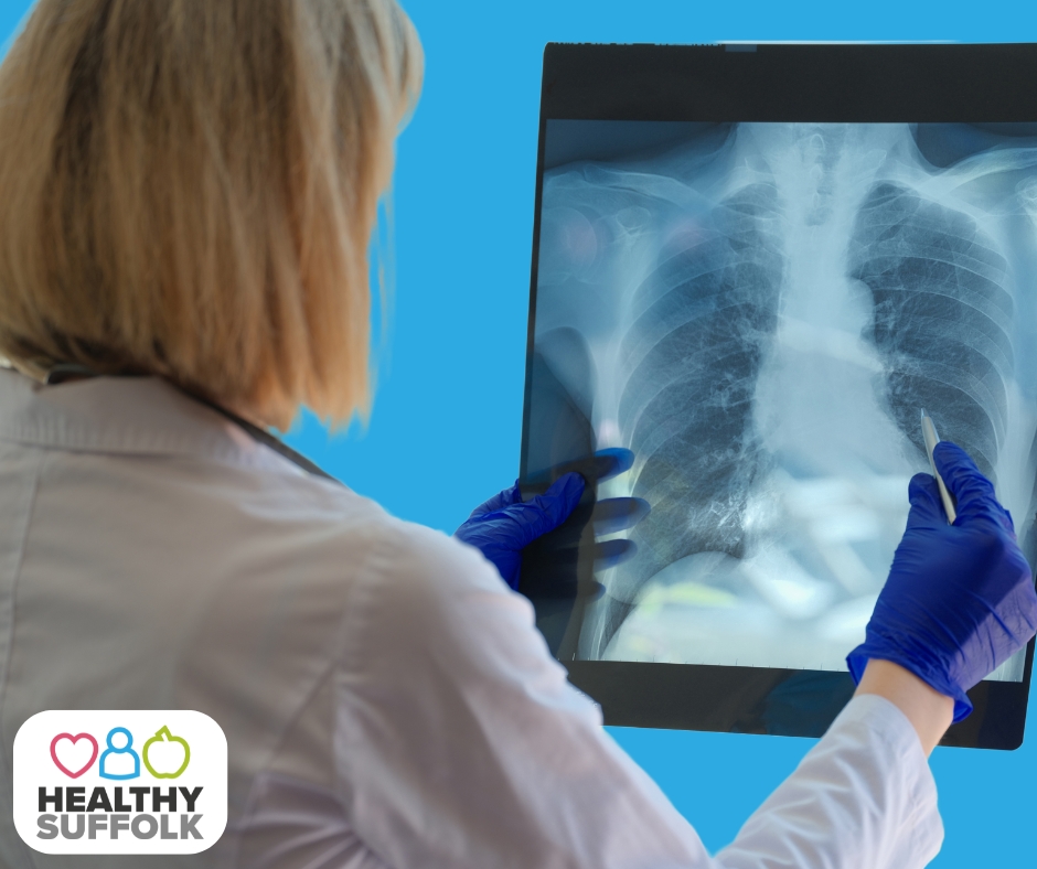 Heath professional holding up an image of a chest X-ray