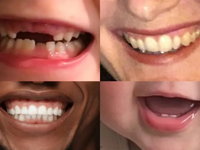 Four big smiles with a varity of teeth on show.